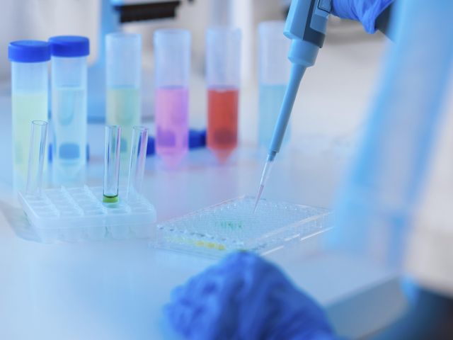 Pipette und Proben in einem medizinischen Labor