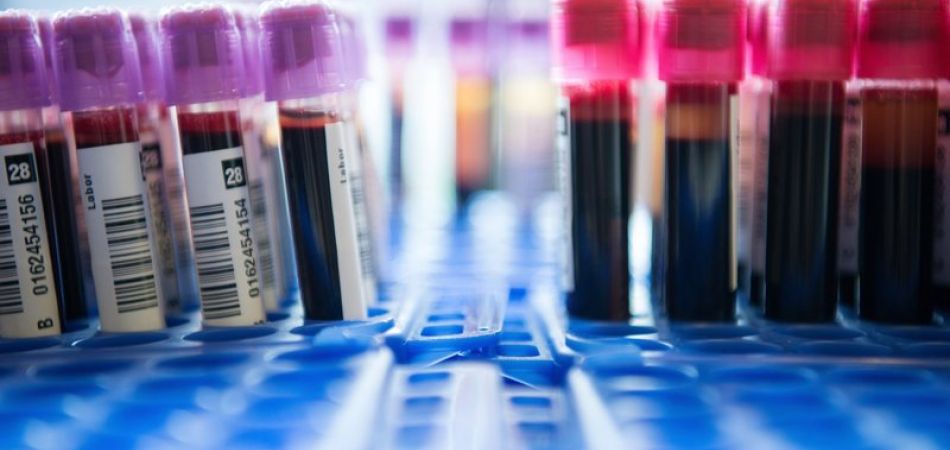 Genetic testing debates in Germany Genetic testing debates in Germany
