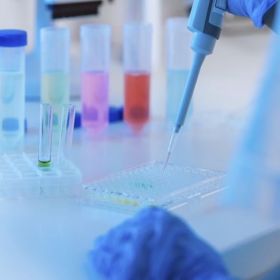 Pipette und Proben in einem medizinischen Labor