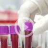 Study: Blood group affects severity of Covid-19 course